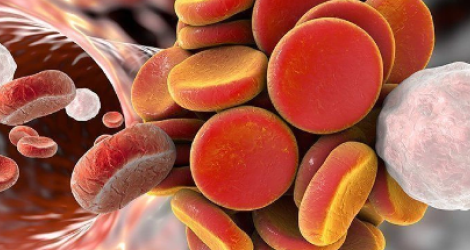  СИМПТОМЫ ПРИ ТРОМБОЗЕ ГЕМОРРОИДАЛЬНОГО УЗЛА