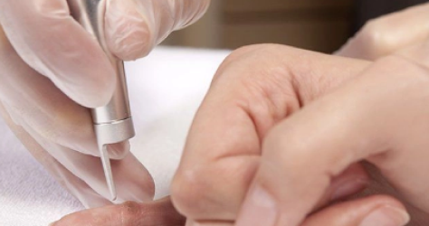 СИМПТОМЫ ПРИ БОРОДАВКАХ